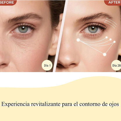 Masajeador De Ojos Quita Ojeras